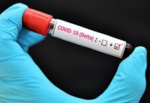 COVID-19 Monitoreo de la variante Delta de SARS-CoV-2