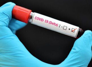 COVID-19 Monitoreo de la variante Delta de SARS-CoV-2