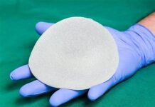 La creciente tendencia de retirar los implantes mamarios